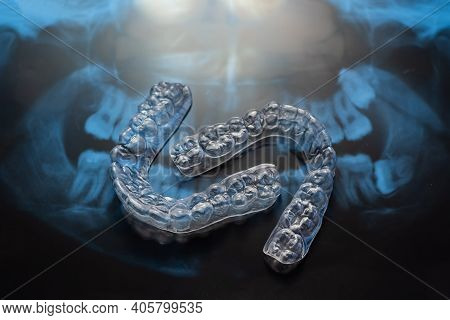 Transparent Bite Correction Trays And X-ray Of The Jaw. Orthodontist Equipment