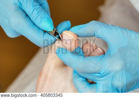 Master Chiropody Removes The Cuticle. Cuticle Treatment Is One Of The Stages Of Processing The Cutic
