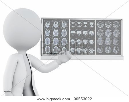 3d white people doctor with cranial brain films