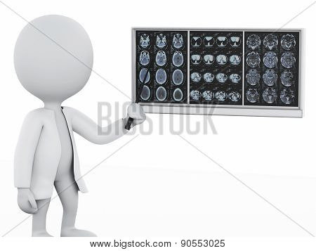 3d white people doctor with cranial brain films