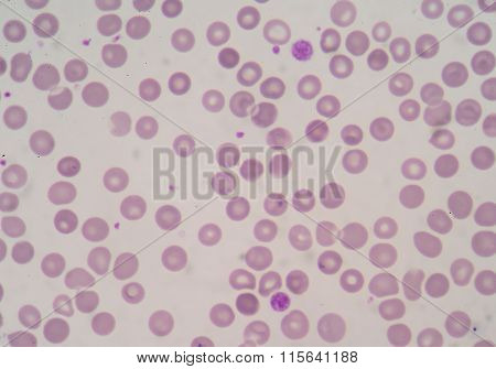 Platelet And White Blood Cells Microscopic