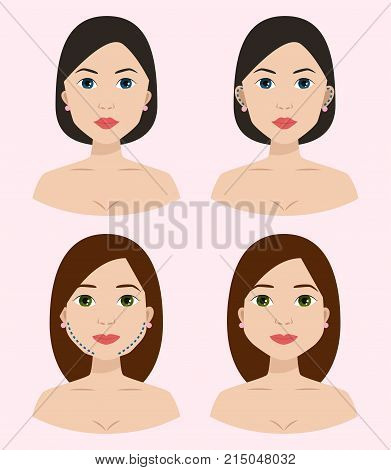 Plastic surgery body parts woman correction anaplasty medicine skin treatment beauty health procedure vector illustration. Human patient medical surgeon person anatomy.