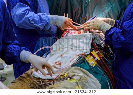 Closeup Of Doctor's Hand In Gloves In The Blood Holds The Forceps During The Operation.