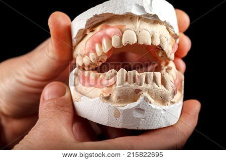 A denture on a gypsum base in the hand of a dentist. Close-up on a black background