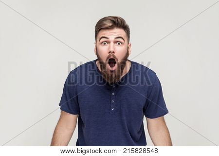 Unbelievable News! Young Adult Man Open Mouth And Shocked