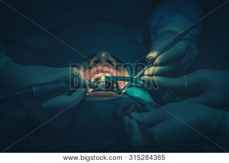 Closeup Dentist And Assistant Operating For Checking And Teeth Cleaning At Dental Clinic, Tooth Care