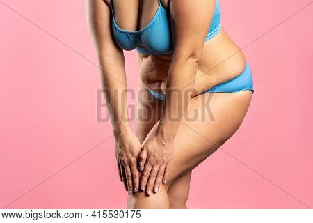 Fat Woman In Blue Underwear On Pink Background, Overweight Female Body
