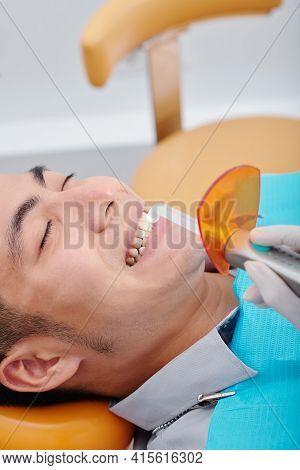 Dentist Using Dental Curing Light For Polymerization Of Dental Composite Resin In Teeth Of Young Asi