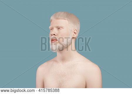 Albinism Concept. Thin Albino Man Posing Without Shirt And Lookig Aside On Turquoise Studio Backgrou