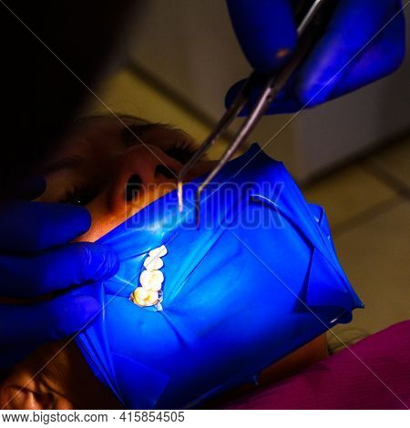 Treatment Of The Upper Sixth Left Tooth, Sterile Treatment With Roofing Felt.
