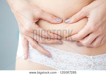Woman dressed in white showing her abdomen localized fat