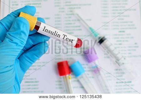 Test tube with blood sample for insulin hormone test