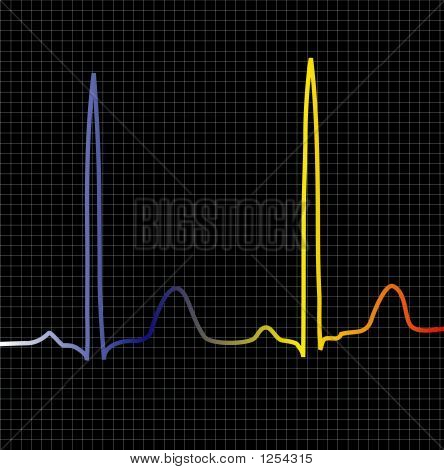 Ecg nero