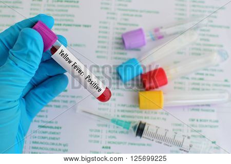 Blood sample positive with yellow fever test