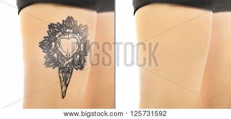 Tattoo on male knee. Laser tattoo removal concept