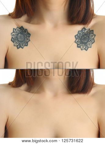 Tattoo on woman collarbones. Laser tattoo removal concept