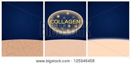 collagen and skin before and after 3 step3