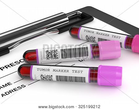 3d Render Of  Blood Samples With Tumor Markers Test Lying On Clipboard