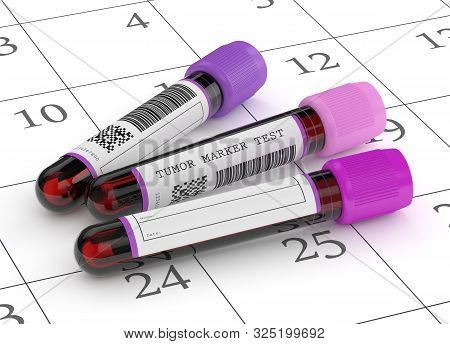 3d Render Of  Blood Samples With Tumor Markers Test Lying On Calendar