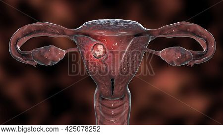 Human Embryo In The Uterus, Scientifically Accurate 3d Illustration. Embryonic Period, Week 8