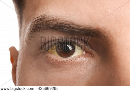 Man With Yellow Eyes On White Background, Closeup. Liver Problems Symptom