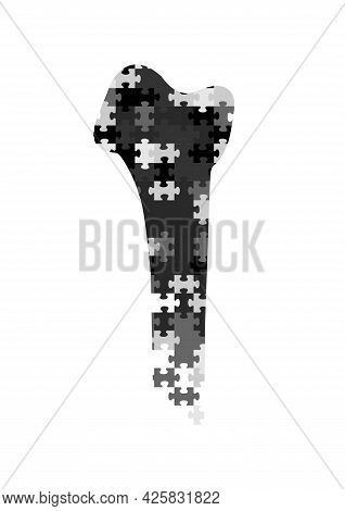 Medical Concept Of Osteoporosis Disease And Other Bone Ailments Vertical Black White Poster Bone Dam
