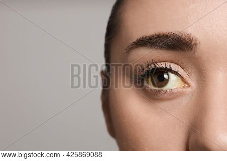 Woman With Yellow Eyes On Grey Background, Closeup And Space For Text. Liver Problems Symptom