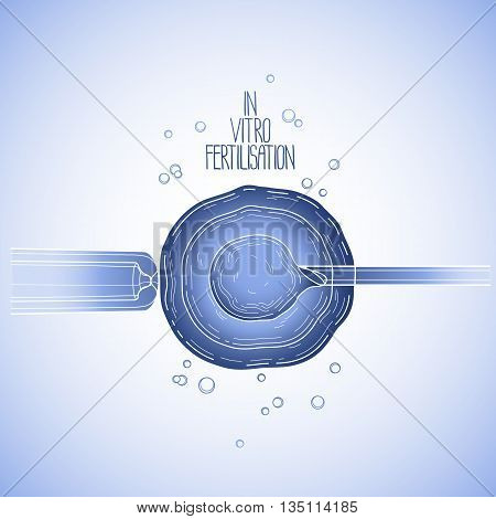 In vitor fertilisation. Artificial insemination. Graphic medical illustration. Vector design in blue colors