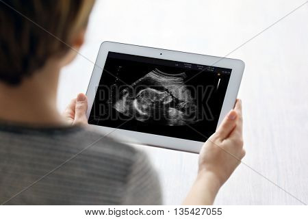 Young woman holding digital tablet with ultrasound scan of baby on screen