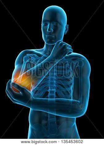 3d rendered, medically accurate 3d illustration of elbow pain