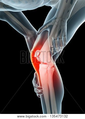3d rendered, medically accurate 3d illustration of knee pain