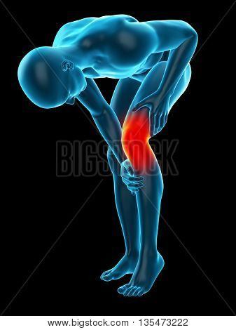 3d rendered, medically accurate 3d illustration of knee pain