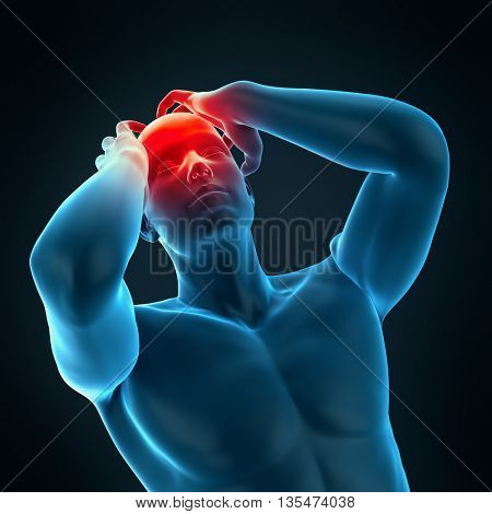 3d rendered, medically accurate 3d illustration of headache/ migraine