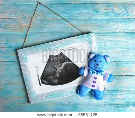 Vintage frame with ultrasound scan of baby on wooden background