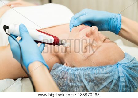 Beautician makes fractional mesotherapy to young woman. The cosmetic procedures for the face. Beauty treatments in the spa salon. Facial Skin Care.