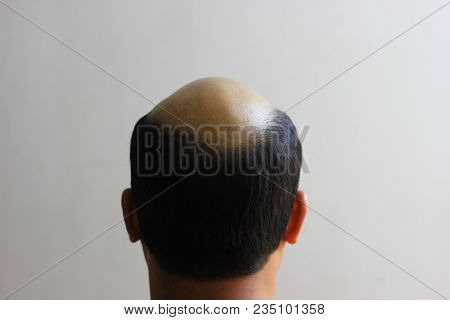 Bald Man In Isolated White Background. View From Behind