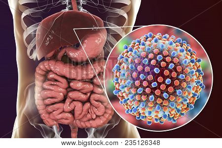 Hepatitis C Virus Infection Medical Concept, 3d Illustration