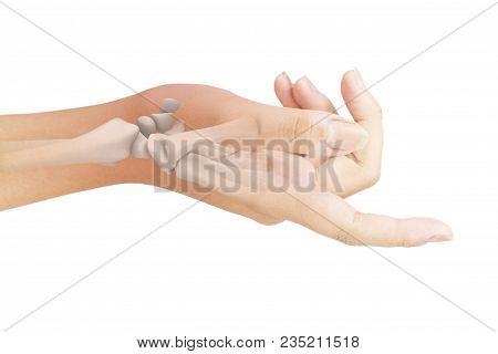 Wrist Bones Injury White Background Wrist Pain