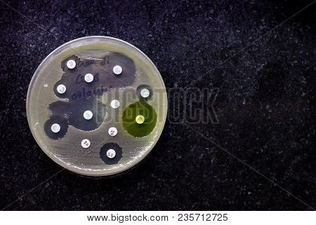 Top View Of Culture Plate Of Bacterial Growth Showing Antibiotic Sensitivity In Their Colony Pattern