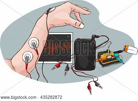 An Experiment In Recording Electrical Impulses Or Emgs (electromyograms) Of Muscles Vector Illustrat