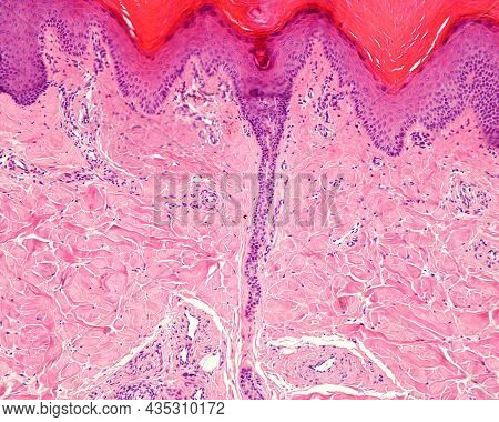 An Excretory Duct Of A Sweat Gland Crosses The Dermis And Leads Into Epidermis At The Level Of A Ret