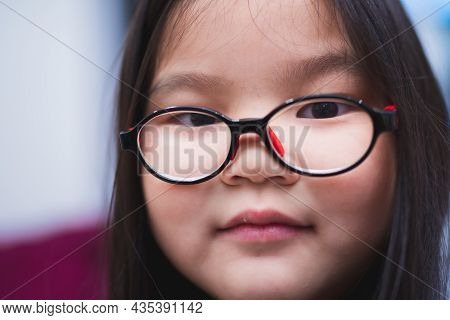 Close-up Of The Face Of A Girl Wearing Glasses To Help Her See From Nearsightedness.