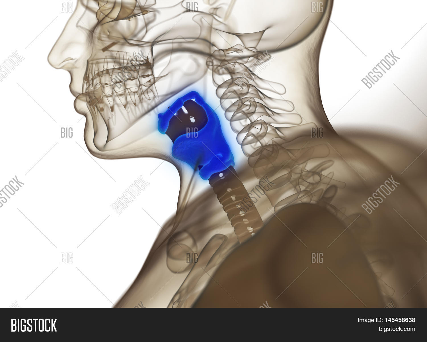 Протез гортани. Протез гортани. Голосовой протез provox 2 10 мм. Протез гортани. 5fr 8мм, ref8132.