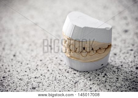 Gypsum model plaster of tooth, denture concept