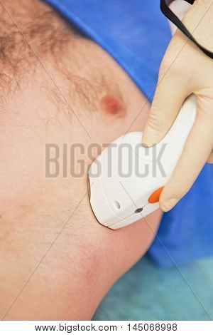 man receiving laser epilation at armpit on beauty center