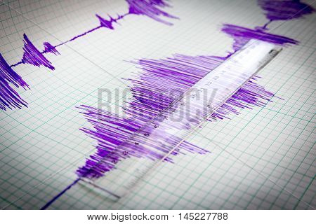 Seismological Device Sheet - Seismometer Vignette