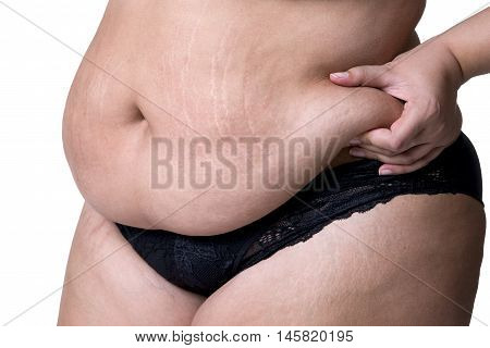 Fat female belly after pregnancy stretch marks closeup isolated on white background