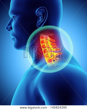 Neck Painful - Cervica Spine Skeleton X-ray, 3D Illustration.