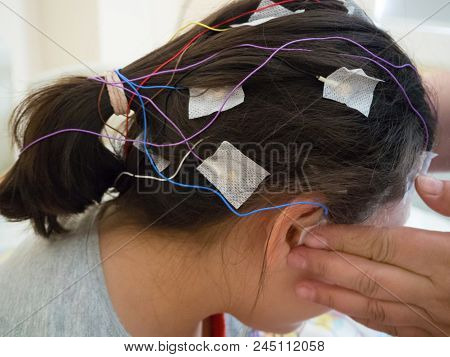 Girl With Eeg Electrodes Attached To Her Head