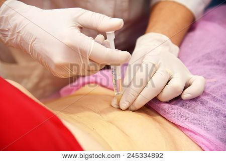 Beauty injections in the salon. The procedure for skin tightening and rejuvenation.